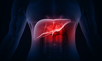 Children's of Alabama