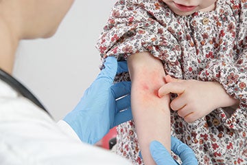 Allergy & Immunology