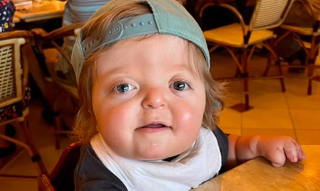 Rhett-Cleft-Alabama